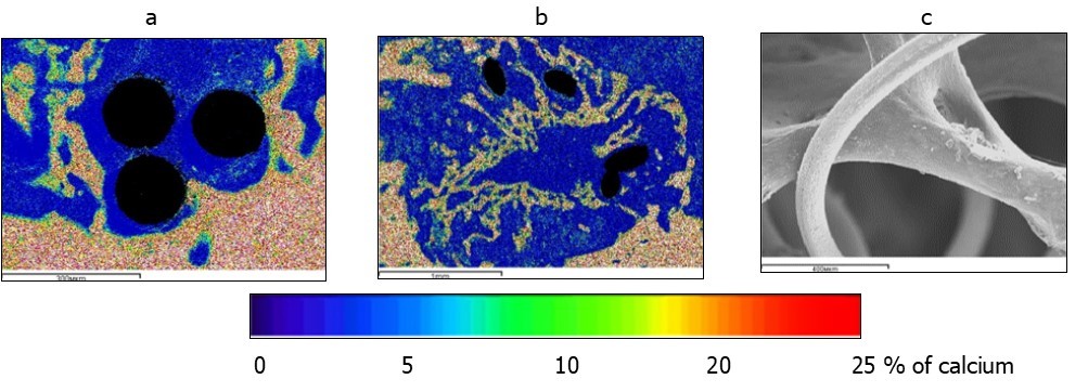 International Journal of Human Anatomy-reparative osteogenesis